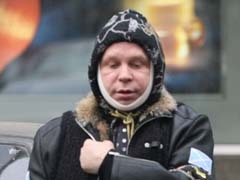 На предновогоднем корпоративе Борис Моисеев получил сильный ожег лица На предновогоднем корпоративе Борис Моисеев получил сильный ожег лица