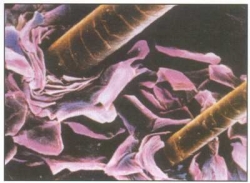 Проверенные методы избавления от перхоти  Проверенные методы избавления от перхоти