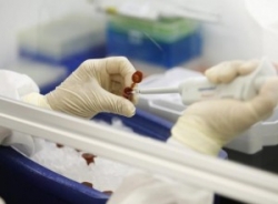 ВОЗ считает, что Беларусь вошла в тройку стран наиболее пострадавших от A/H1N1 ВОЗ считает, что Беларусь вошла в тройку стран наиболее пострадавших от A/H1N1