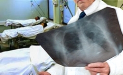 Как избежать пневмонии?  Как избежать пневмонии?